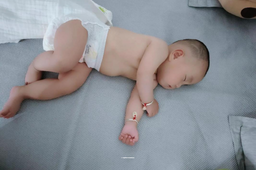 东明六个月宝宝眼睛散光